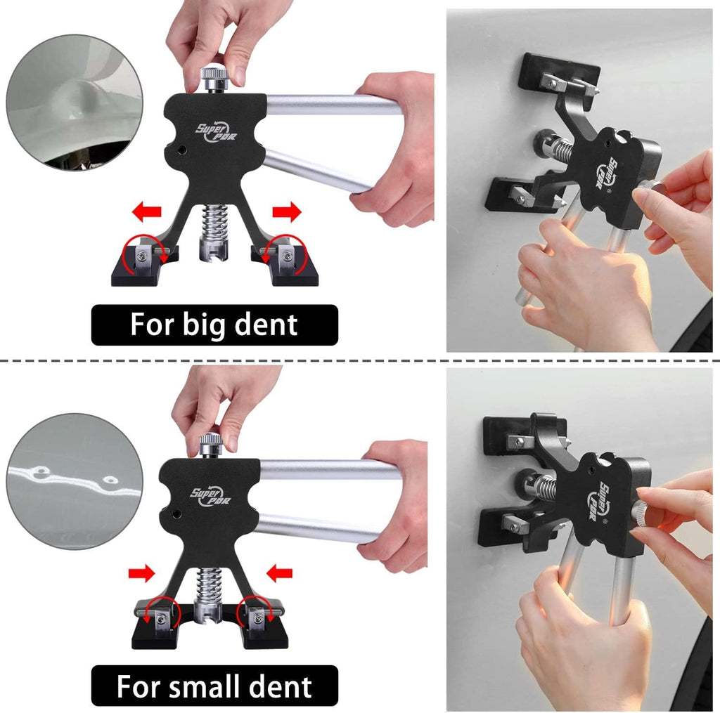 Paintless Dent Repair Kit with Bridge Dent Puller Q545388